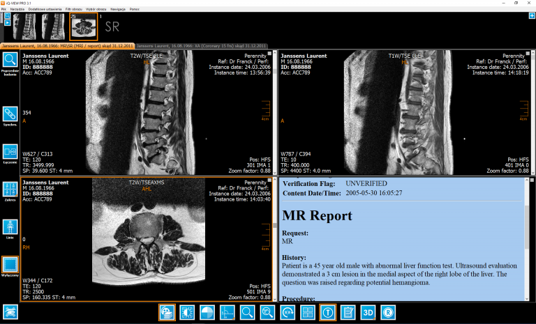 Przeglądarka DICOM - IQ VIEW PRO (licencja roczna)